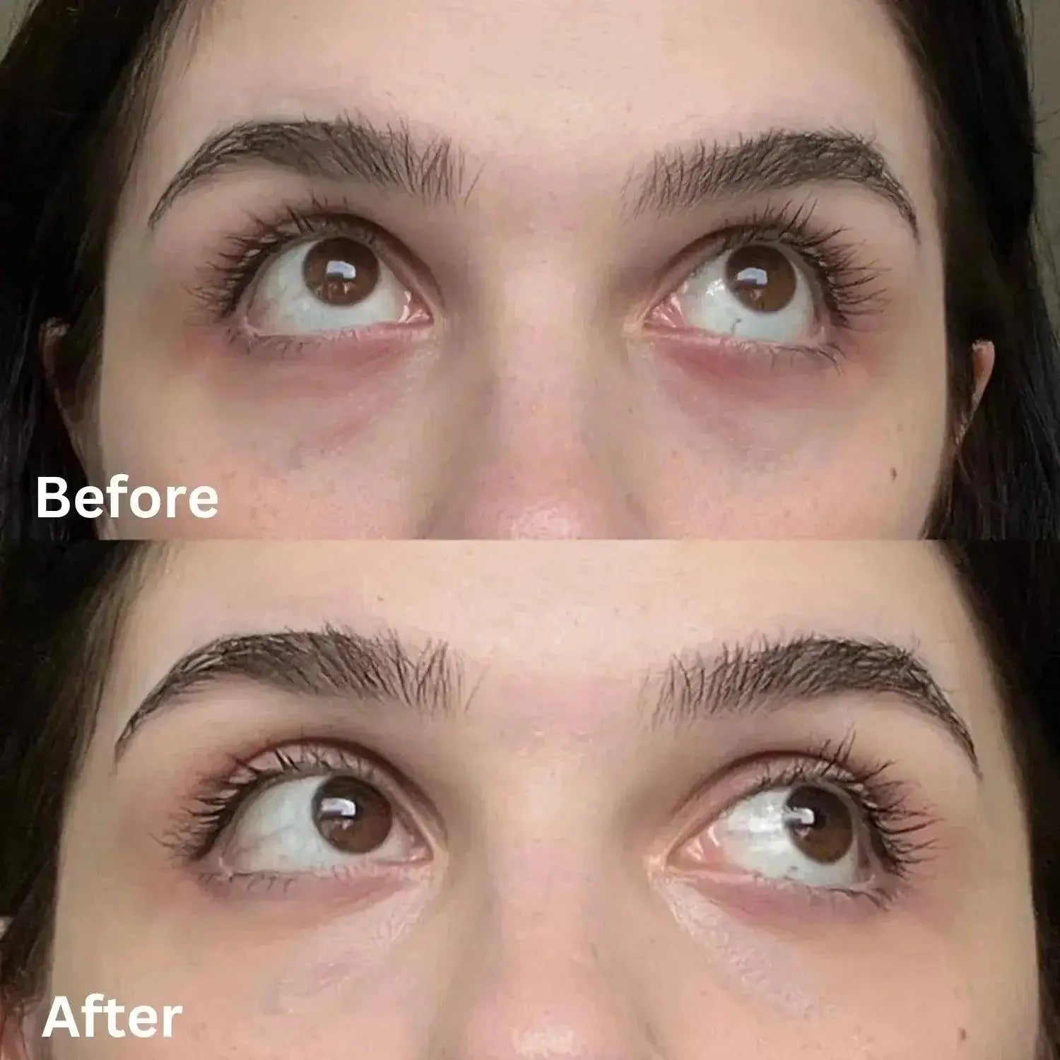 Before and after using SKINFOOD Salmon Dark Circle Concealer Cream 01 Blooming 10g for dark circles.