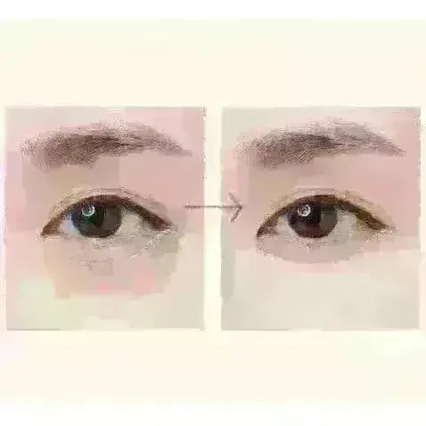 Before and after effect using SKINFOOD Salmon Dark Circle Concealer Cream 01 Blooming 10g on under-eye circles.